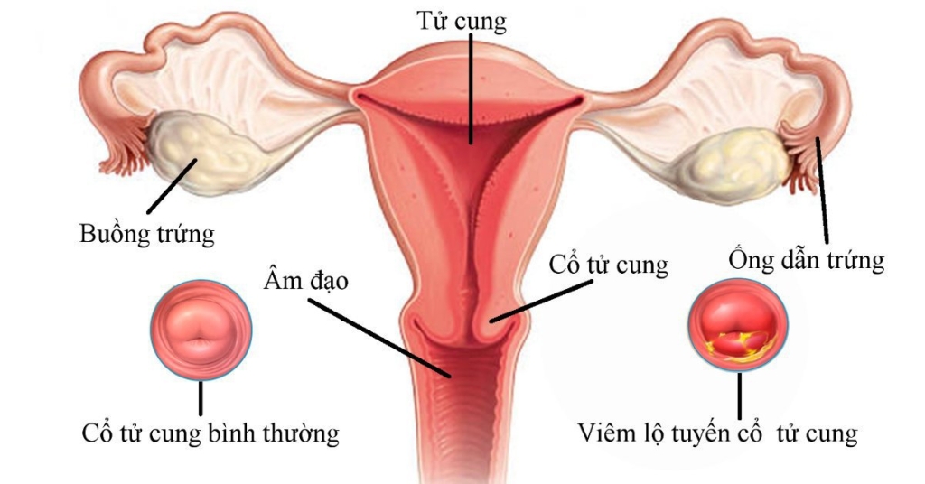 phuong-phap-tham-do-tu-cung-an-toan