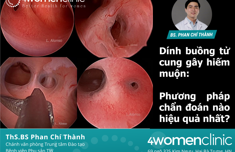 Dính Buồng Tử Cung Gây Hiếm Muộn