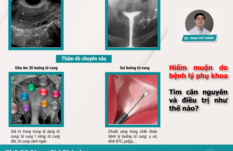 Hiếm Muộn Do Bệnh Lý Phụ Khoa. Tìm Căn Nguyên Và điều Trị Như Thế Nào 01