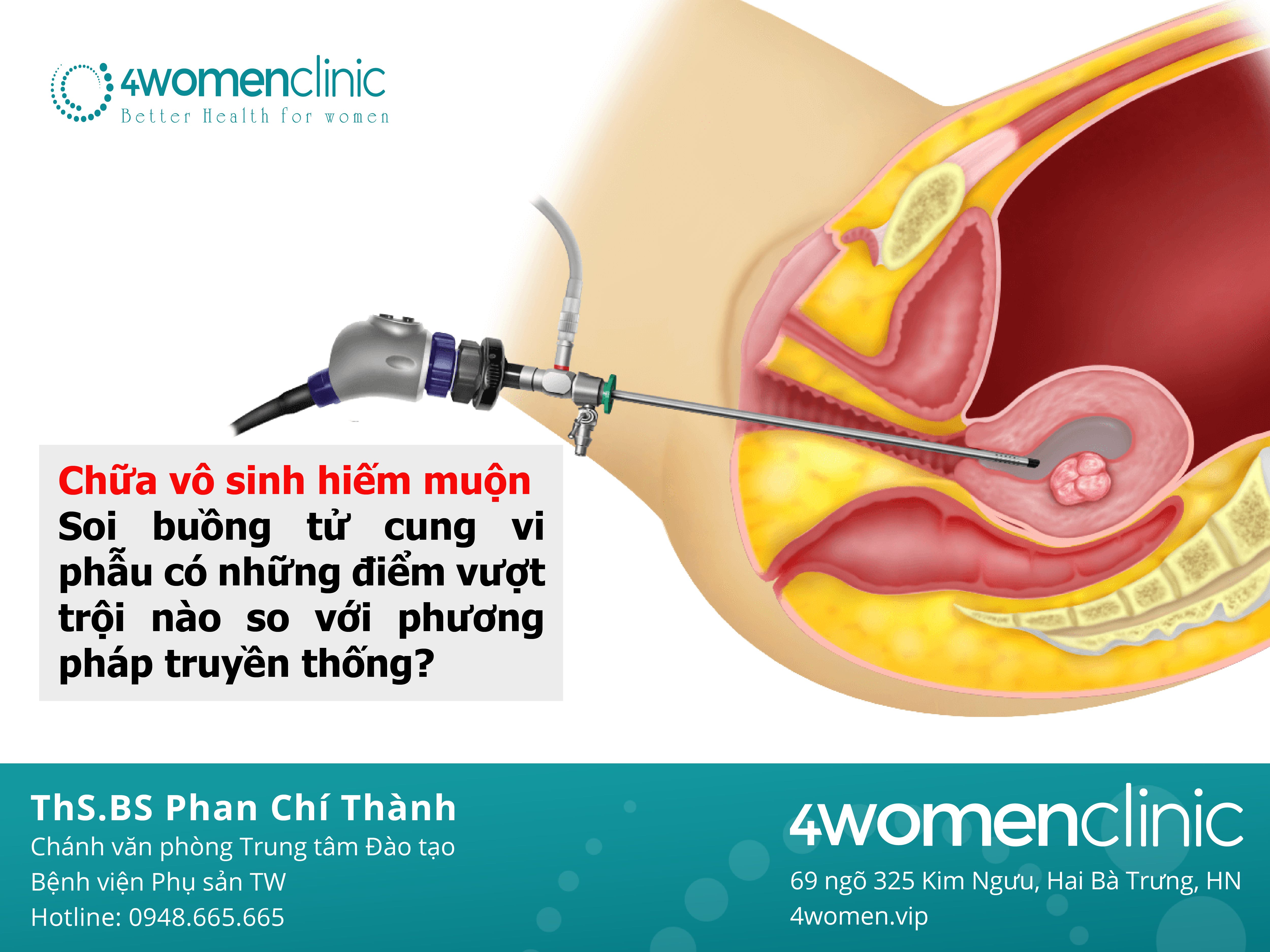 So Sánh Sbtc 01