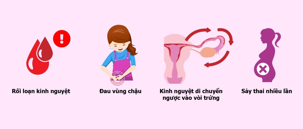 Triệu chứng dính buồng tử cung