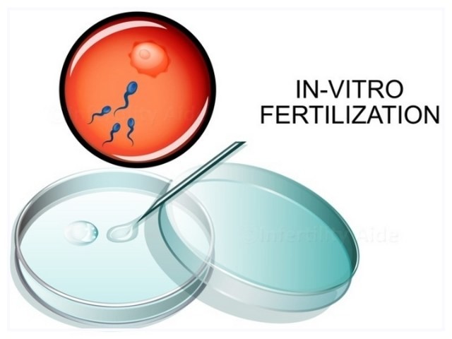 In Vitro Fertilization 1