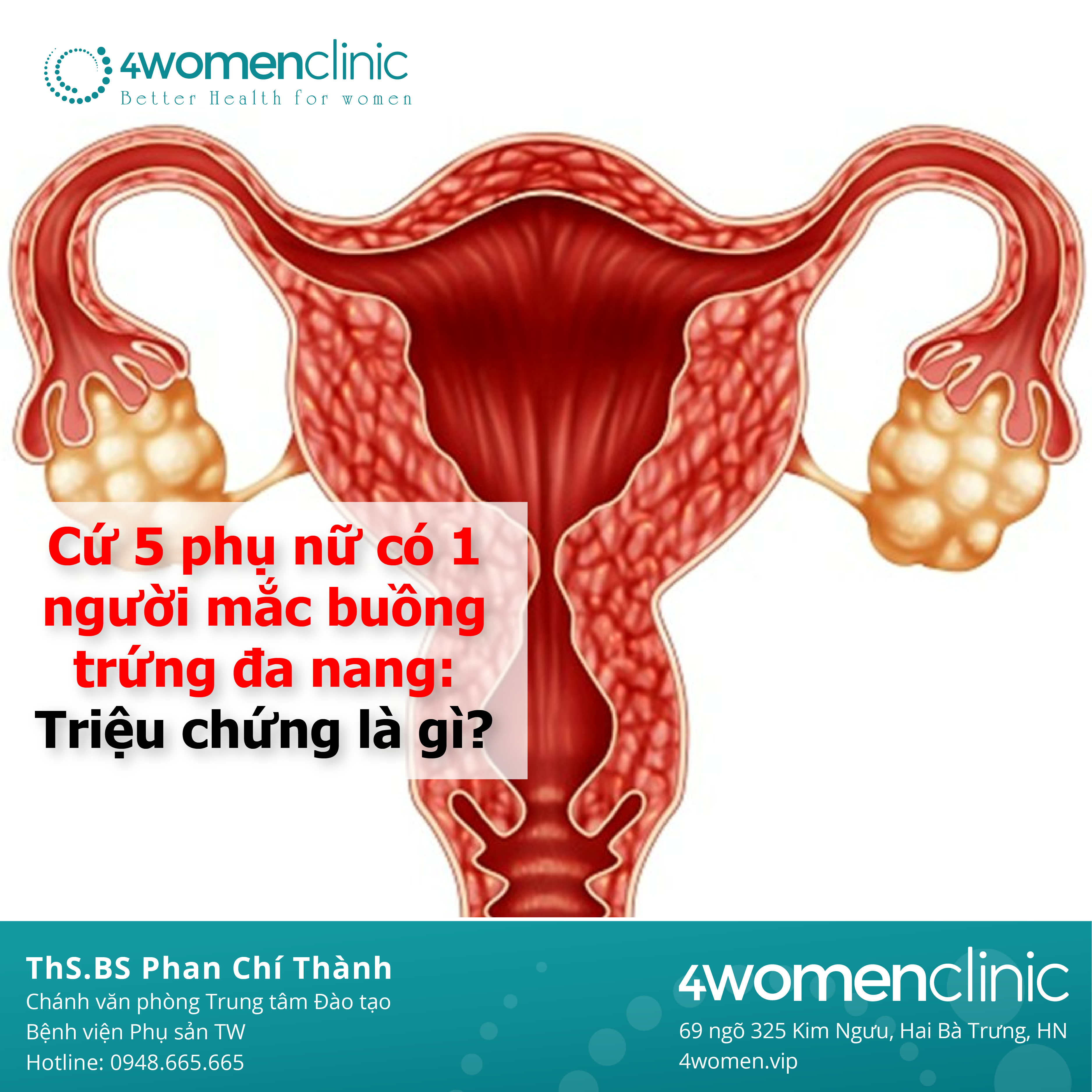 Triệu Chứng Pcos 01